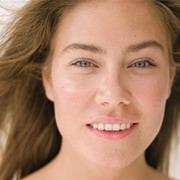 Beneficios del tratamiento con carillas dentales