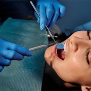 ¿Cada cuánto tiempo debemos realizar una limpieza dental?