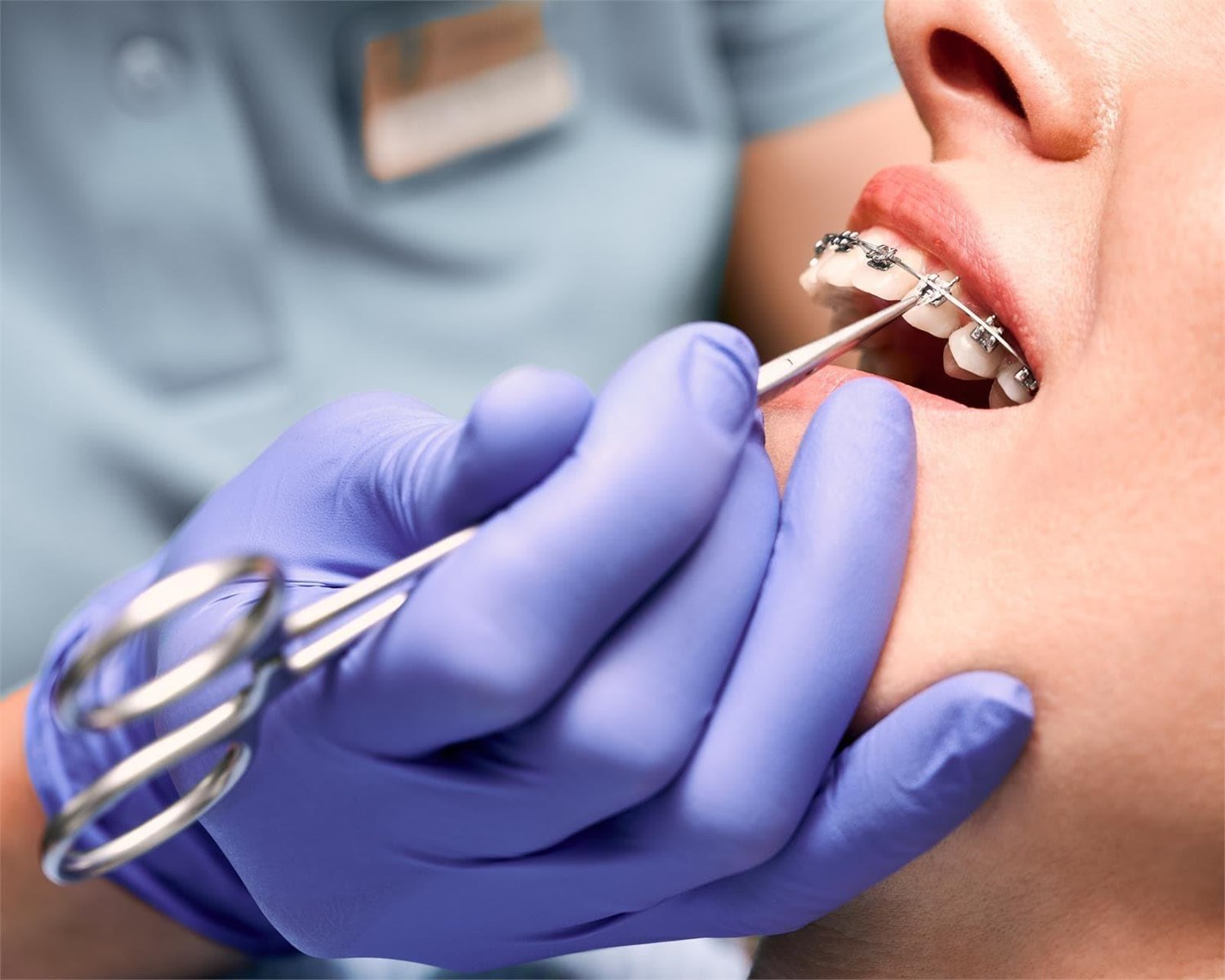 ¿Cómo saber que necesitas un tratamiento de ortodoncia?