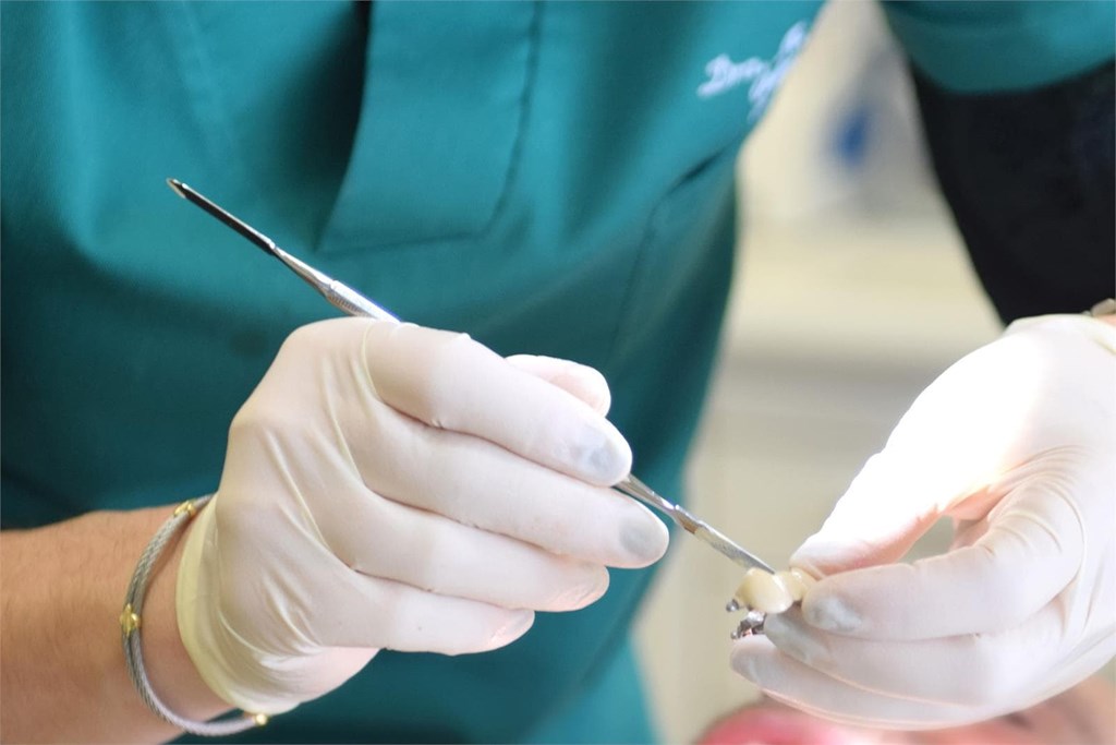 ¿Cuándo debo empezar un tratamiento con implantes dentales?