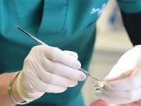 ¿Cuándo debo empezar un tratamiento con implantes dentales?