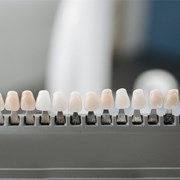 ¿Cuánto tiempo duran las carillas dentales?
