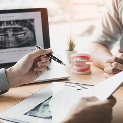 ¿De qué depende el éxito de los implantes dentales?