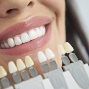 Diferencias entre las carillas de composite y las de porcelana