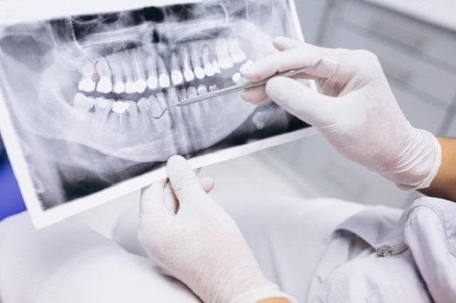 ¿En qué consiste la endodoncia?