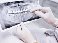 ¿En qué consiste la endodoncia?