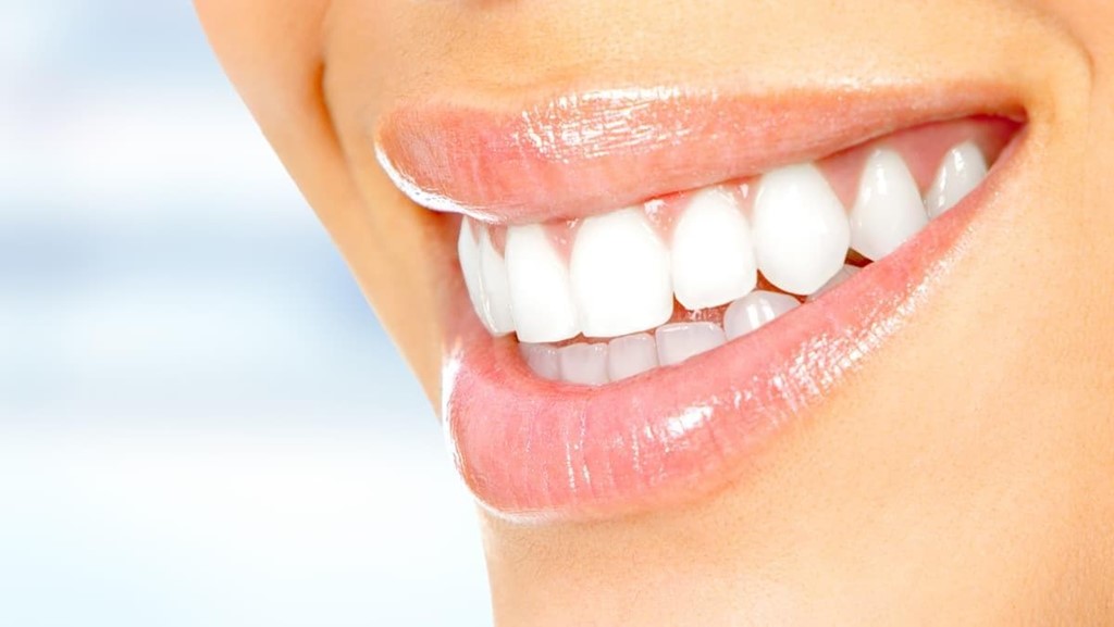 ¿Es necesario un cepillo de dientes diferente en caso de ponerme carillas dentales?
