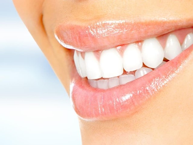 ¿Es necesario un cepillo de dientes diferente en caso de ponerme carillas dentales?