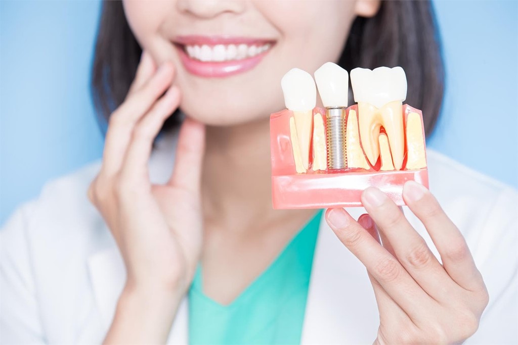 ¿Has perdido un diente? Recupera tu sonrisa con la implantología dental