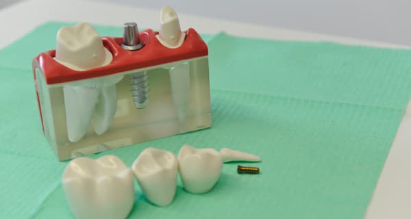 Otros tratamientos dentales