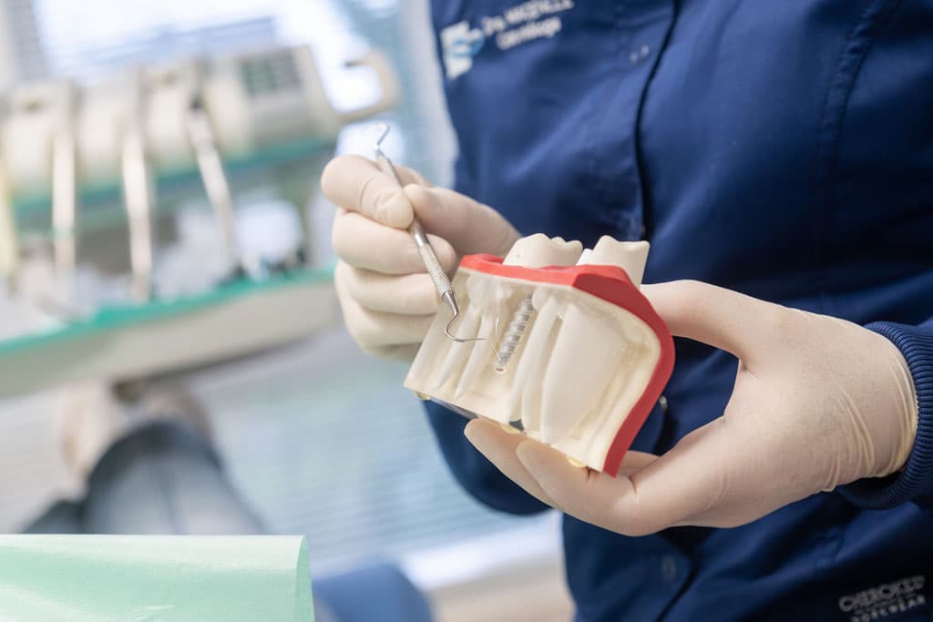 Poner implante dental en Clínica dental en Culleredo