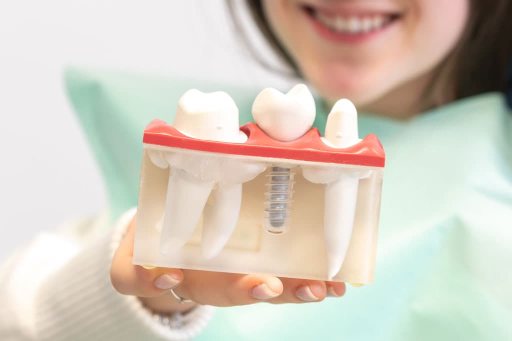 Poner implante dental en clínica en Oleiros