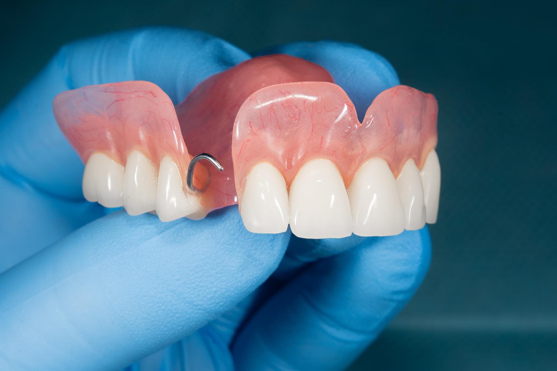 Prótesis dentales para recuperar la funcionalidad de tu boca
