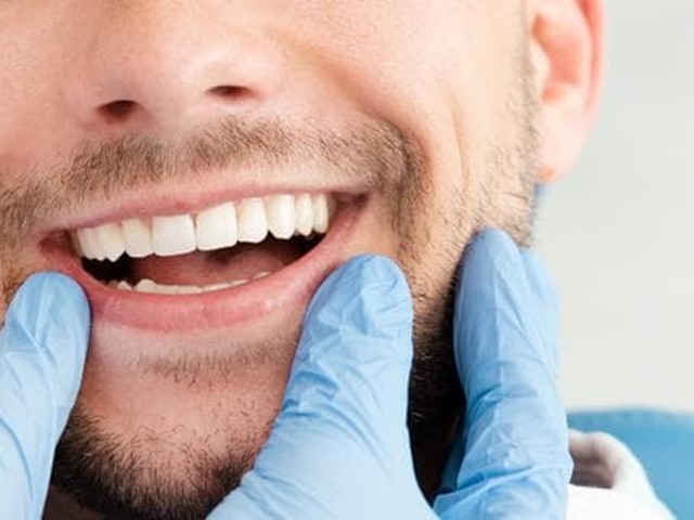 Los beneficios de la estética dental para tu salud y autoestima