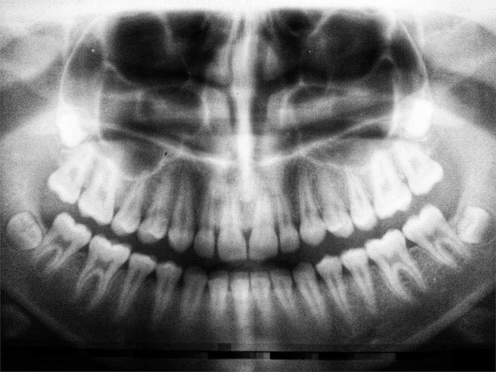 ¿Prejuicios frente a la endodoncia?