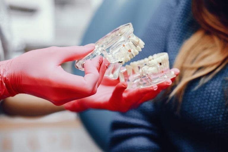 ¿Qué debes saber antes de someterte a un tratamiento de implantología dental? 