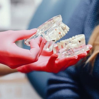 ¿Qué debes saber antes de someterte a un tratamiento de implantología dental?