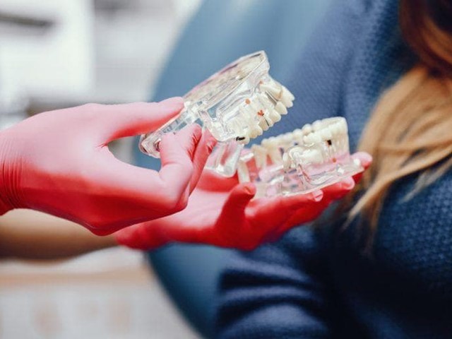 ¿Qué debes saber antes de someterte a un tratamiento de implantología dental? 