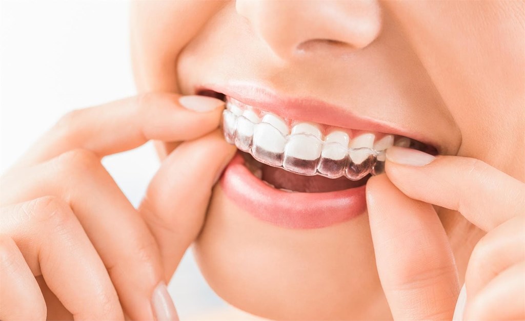 ¿Qué tipo de ortodoncia se adapta mejor a tus necesidades?
