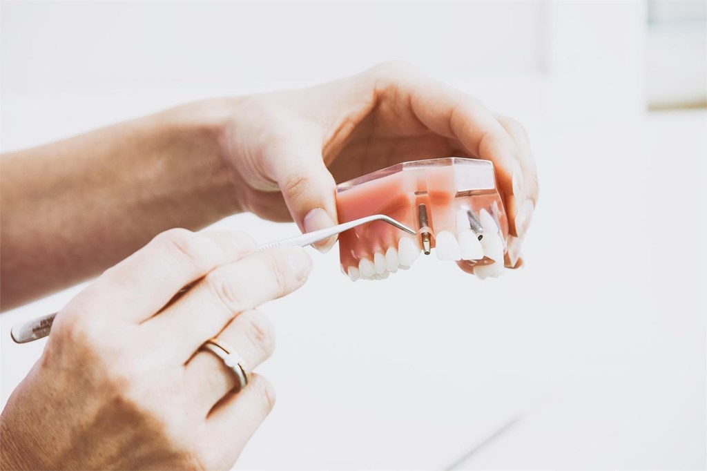 Tipos y características de las prótesis dentales removibles
