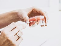 Tipos y características de las prótesis dentales removibles
