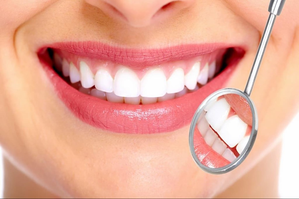 Ventajas de los tratamientos con carillas dentales