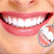 Ventajas de los tratamientos con carillas dentales